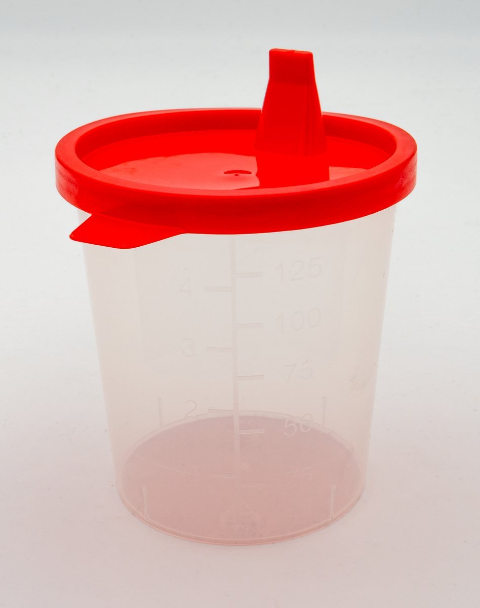 An empty clear plastic urine specimen cup with a red snap lid and printed measuring marks, on a white background.